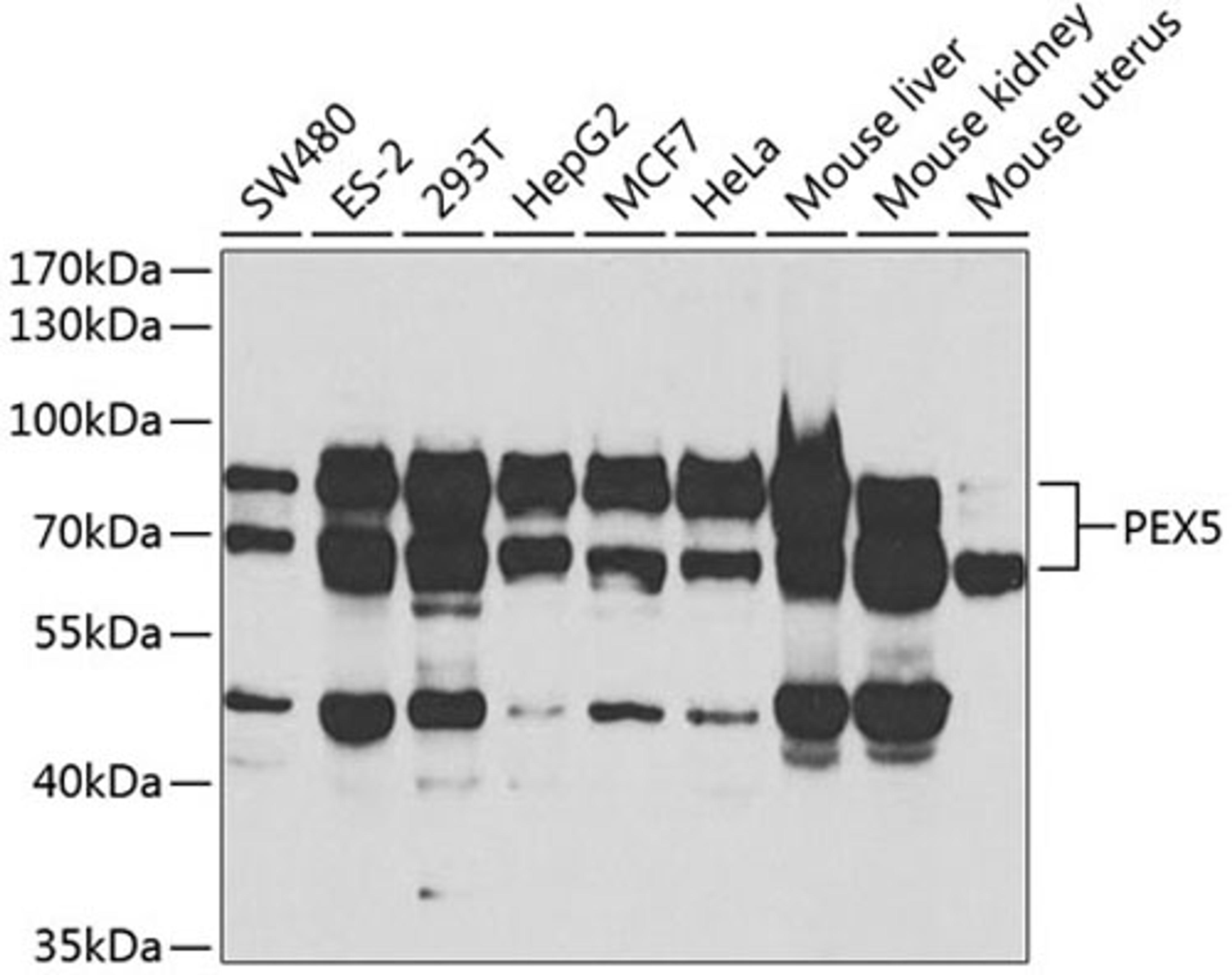 Western blot - PEX5 antibody (A5780)