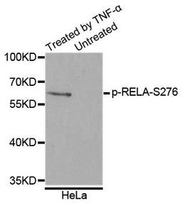 Western blot analysis of extracts of HeLa cell lines using RELA (Phospho-S276) antibody