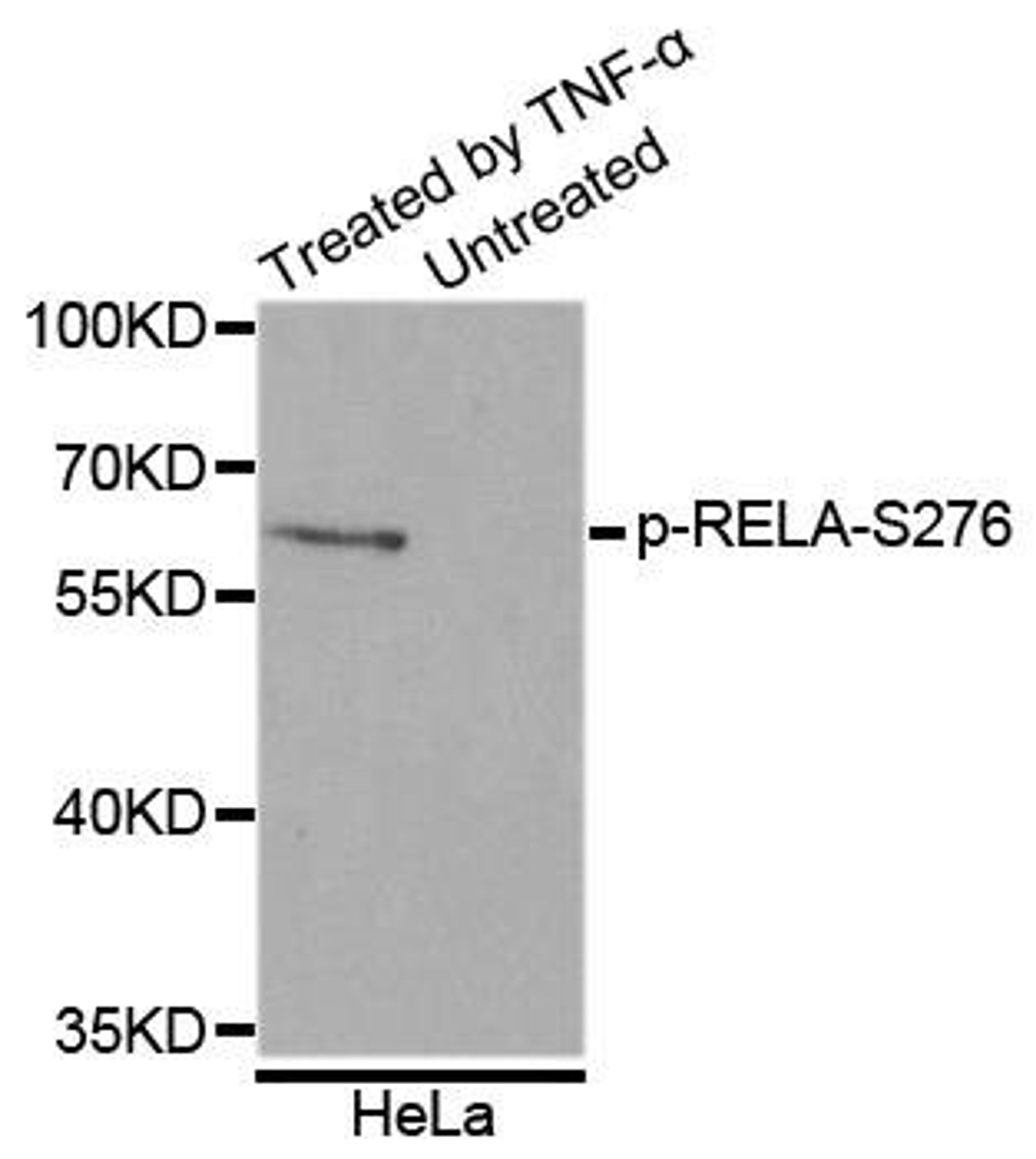 Western blot analysis of extracts of HeLa cell lines using RELA (Phospho-S276) antibody