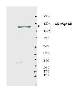 Western blot analysis of whole LNCaP cell extracts using pRb2 p130 antibody