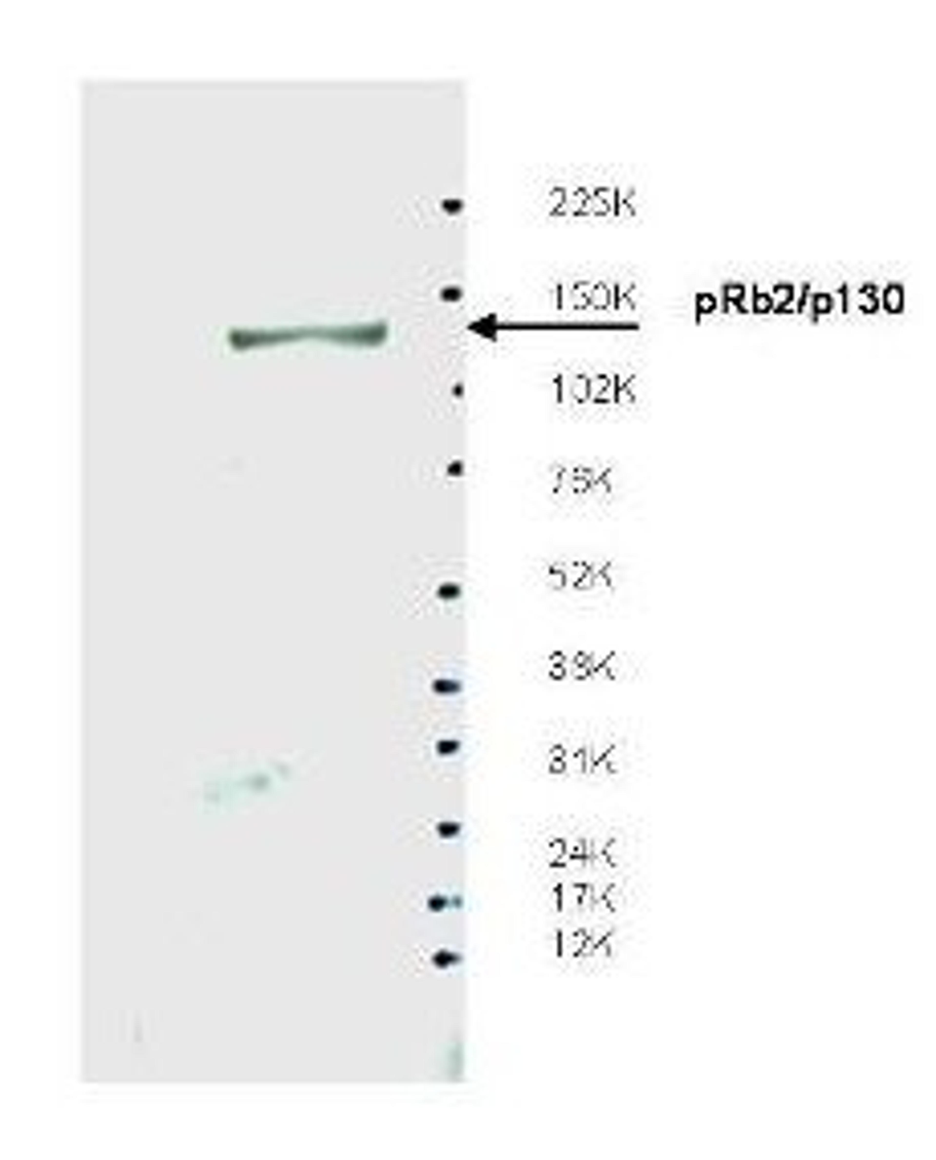 Western blot analysis of whole LNCaP cell extracts using pRb2 p130 antibody