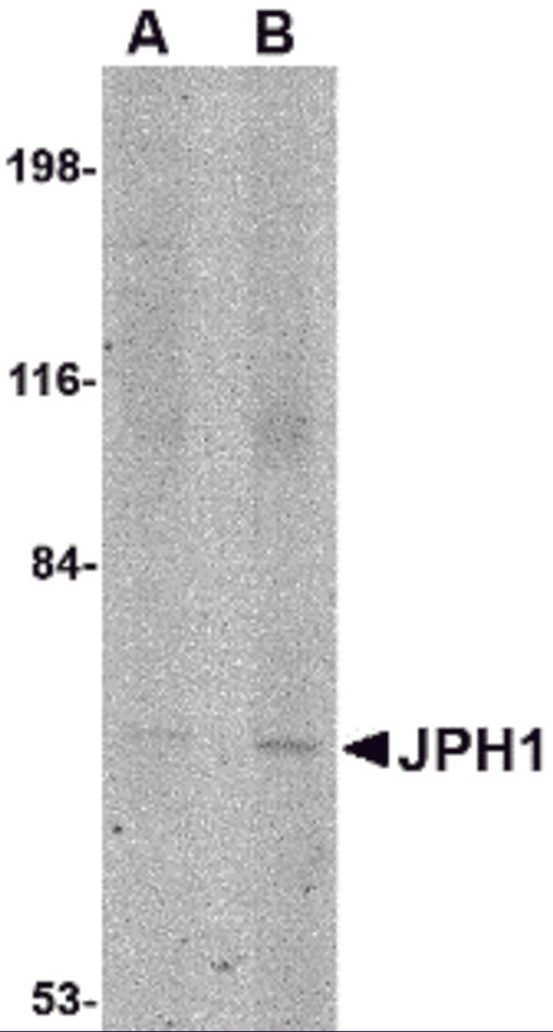 Western blot analysis of JPH1 in 293 cell lysate with JPH1 antibody at (A) 1 and (B) 2 &#956;g/mL.