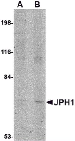 Western blot analysis of JPH1 in 293 cell lysate with JPH1 antibody at (A) 1 and (B) 2 &#956;g/mL.