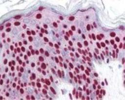 Immunohistochemistry-Paraffin: Smad3 [p Ser423, p Ser425] Antibody [NBP1-77836] - Detect signal in a variety of tissues including multi-human, multi-brain and multi-cancer slides. This image shows strong nuclear staining in the majority of epidermal keratinocytes at 40X.  The image shows localization of the antibody as the precipitated red signal, with a hematoxylin purple nuclear counterstain.