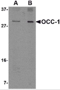 Western blot analysis of OCC-1 in 293 cell lysate with OCC-1 antibody at (A) 2 μg/mL and (B) 4 μg/mL.