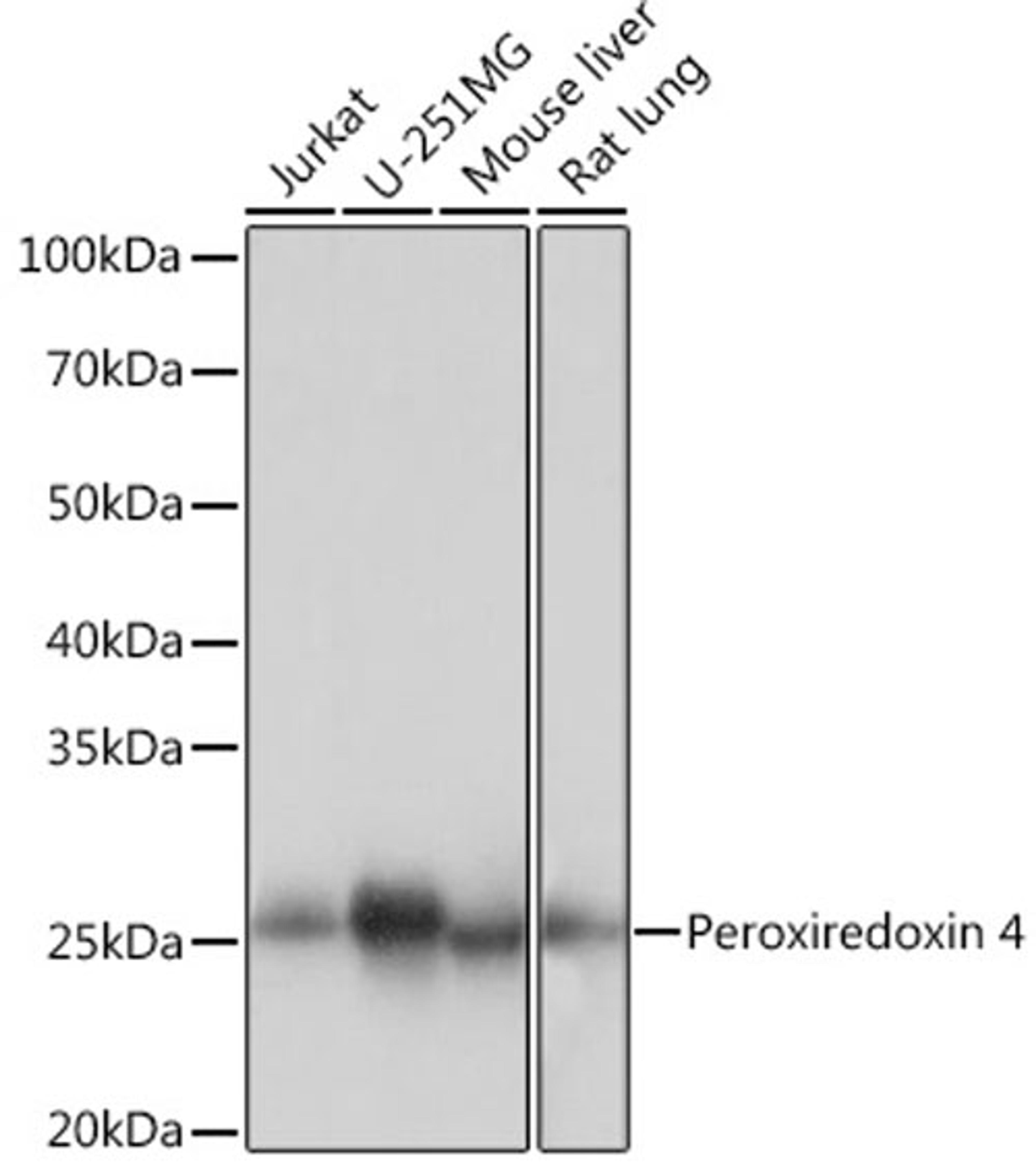 Western blot - Peroxiredoxin 4 Rabbit mAb (A9131)