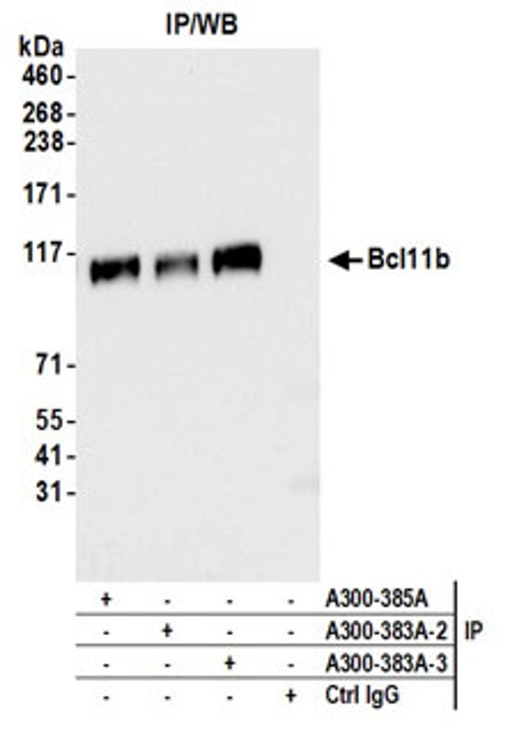 Detection of human Bcl11b by western blot of immunoprecipitates.