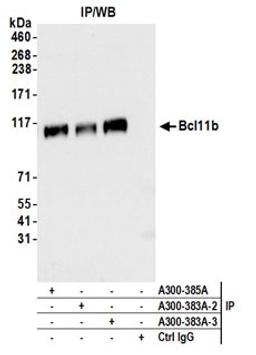 Detection of human Bcl11b by western blot of immunoprecipitates.