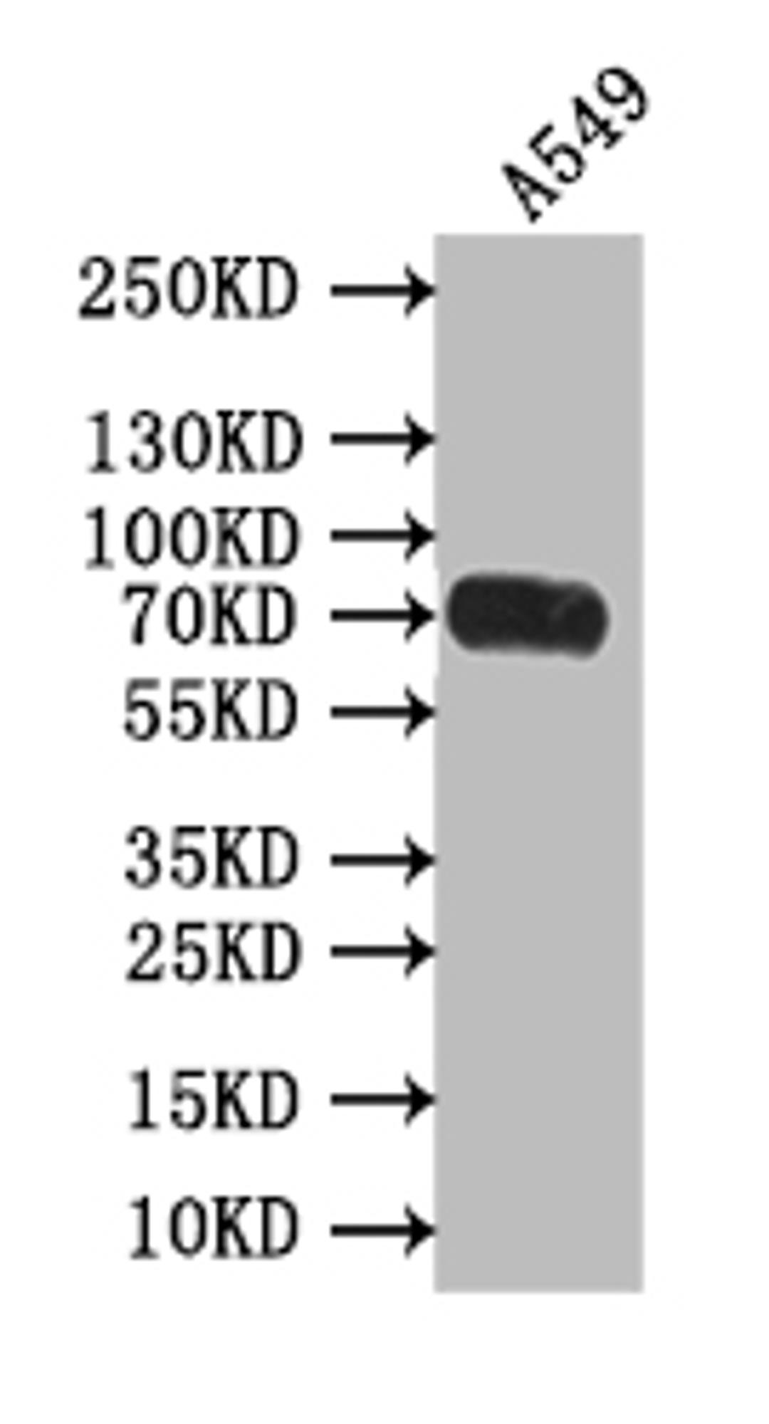 Western Blot. Positive WB detected in: A549 whole cell lysate. All lanes: Poliovirus Receptor antibody at 1:500. Secondary. Goat polyclonal to rabbit IgG at 1/50000 dilution. Predicted band size: 70 kDa. Observed band size: 70 kDa.