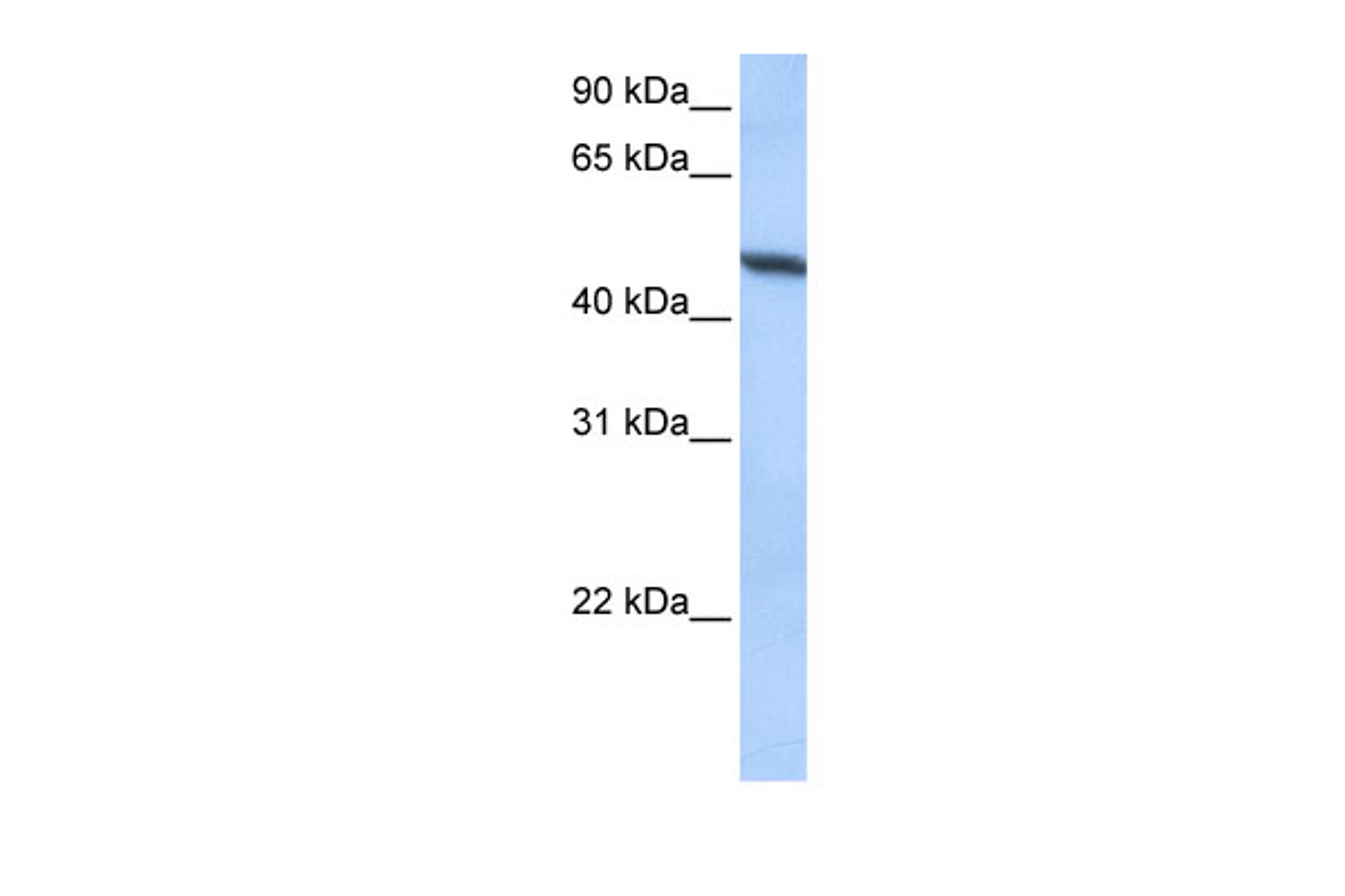 Antibody used in WB on Human HeLa at 0.2-1 ug/ml.