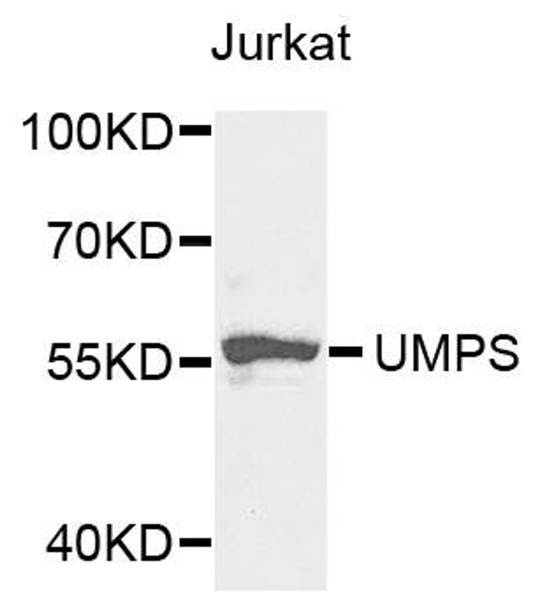 Western blot analysis of extracts of Jurkat cells using UMPS antibody