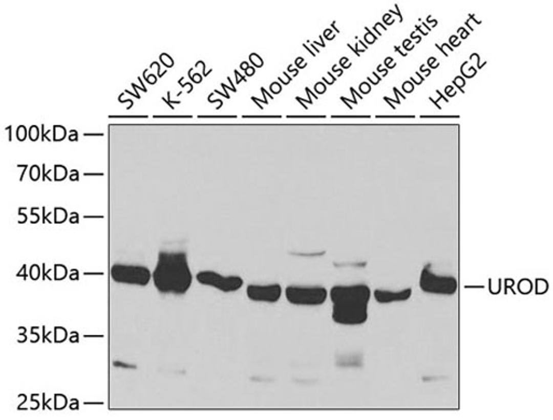 Western blot - UROD antibody (A5493)