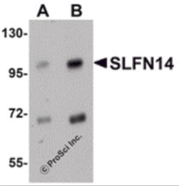 Western blot analysis of SLFN14 in mouse kidney tissue lysate with SLFN14 antibody at (A) 1 and (B) 2 &#956;g/mL.