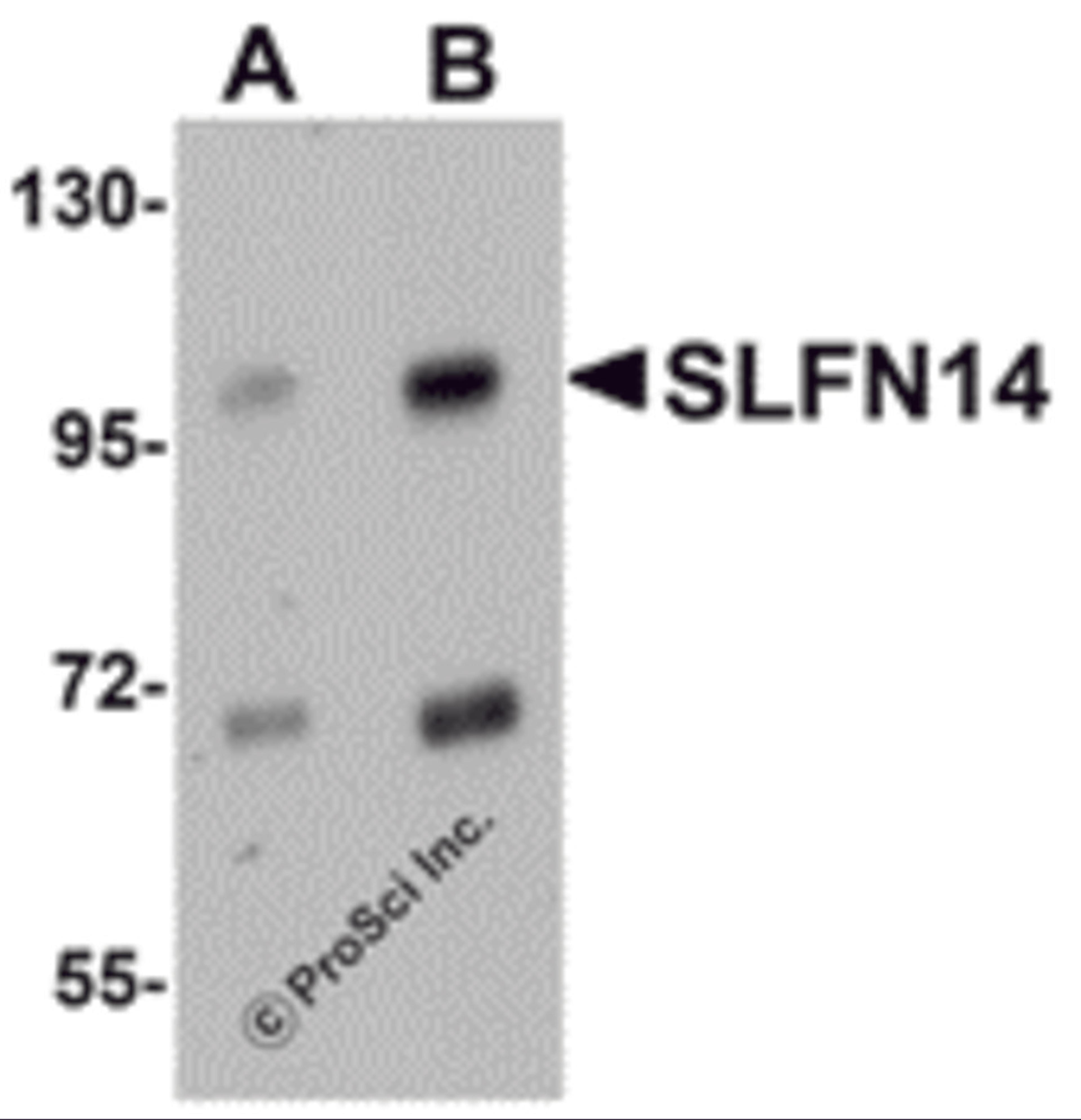 Western blot analysis of SLFN14 in mouse kidney tissue lysate with SLFN14 antibody at (A) 1 and (B) 2 &#956;g/mL.