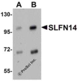 Western blot analysis of SLFN14 in mouse kidney tissue lysate with SLFN14 antibody at (A) 1 and (B) 2 μg/mL.