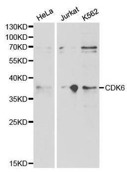 Western blot analysis of extracts of various cell lines using CDK6 antibody