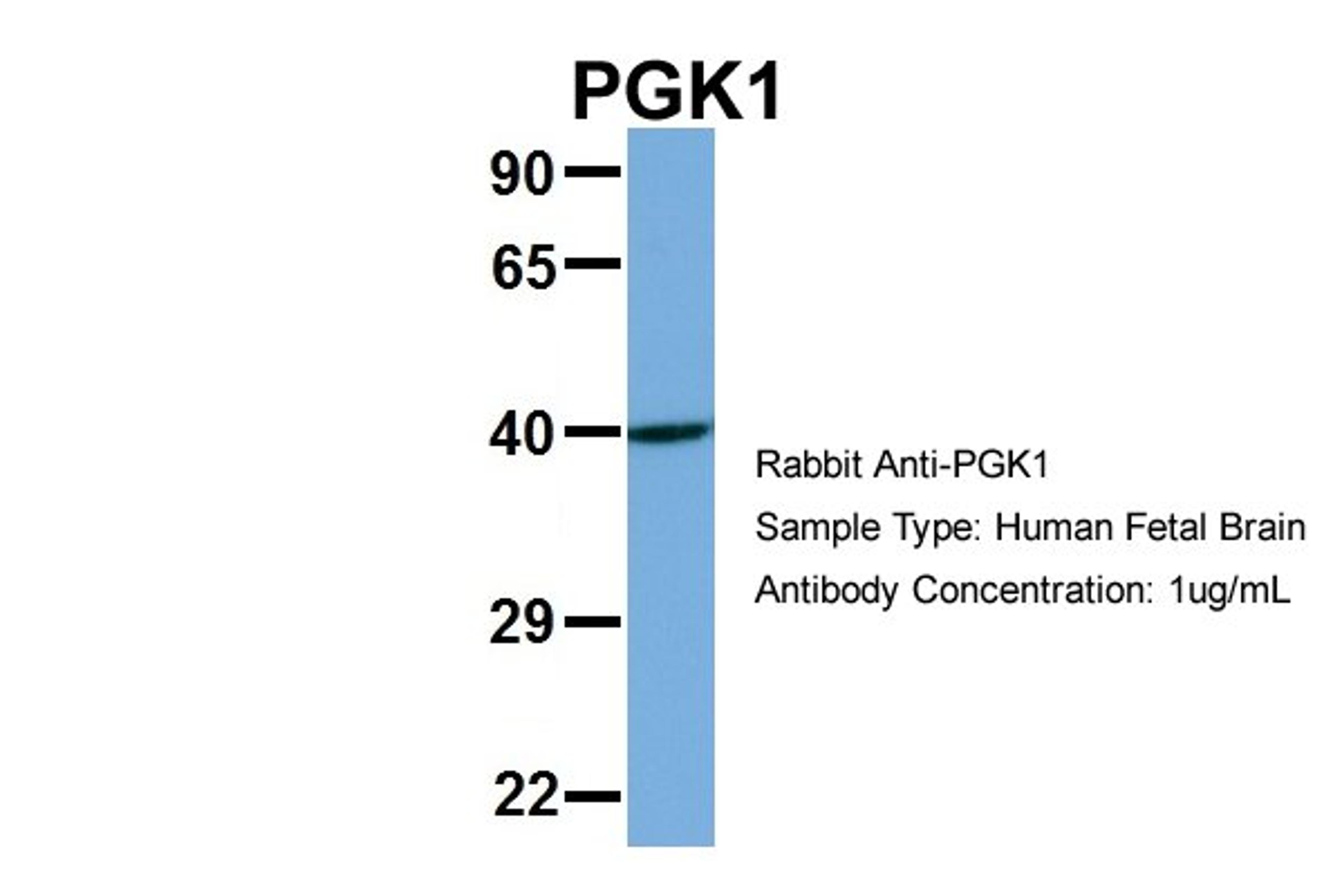 Antibody used in WB on Hum. Fetal Brain at 1 ug/ml.