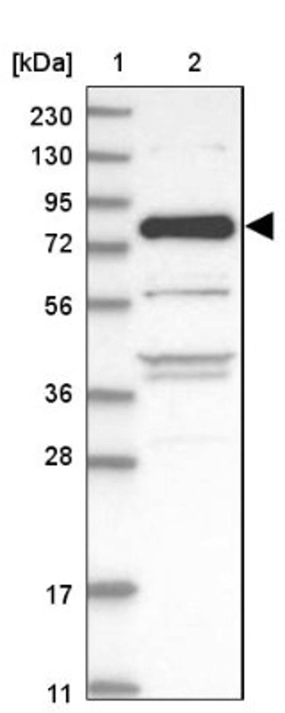 Western Blot: ZNF295 Antibody [NBP1-82923] - Lane 1: Marker [kDa] 230, 130, 95, 72, 56, 36, 28, 17, 11<br/>Lane 2: Human cell line RT-4