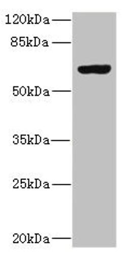 Western blot. All lanes: SLC13A2 antibody at 1.29µg/ml + 293T whole cell lysate. Secondary. Goat polyclonal to rabbit IgG at 1/10000 dilution. Predicted band size: 65, 70 kDa. Observed band size: 65 kDa