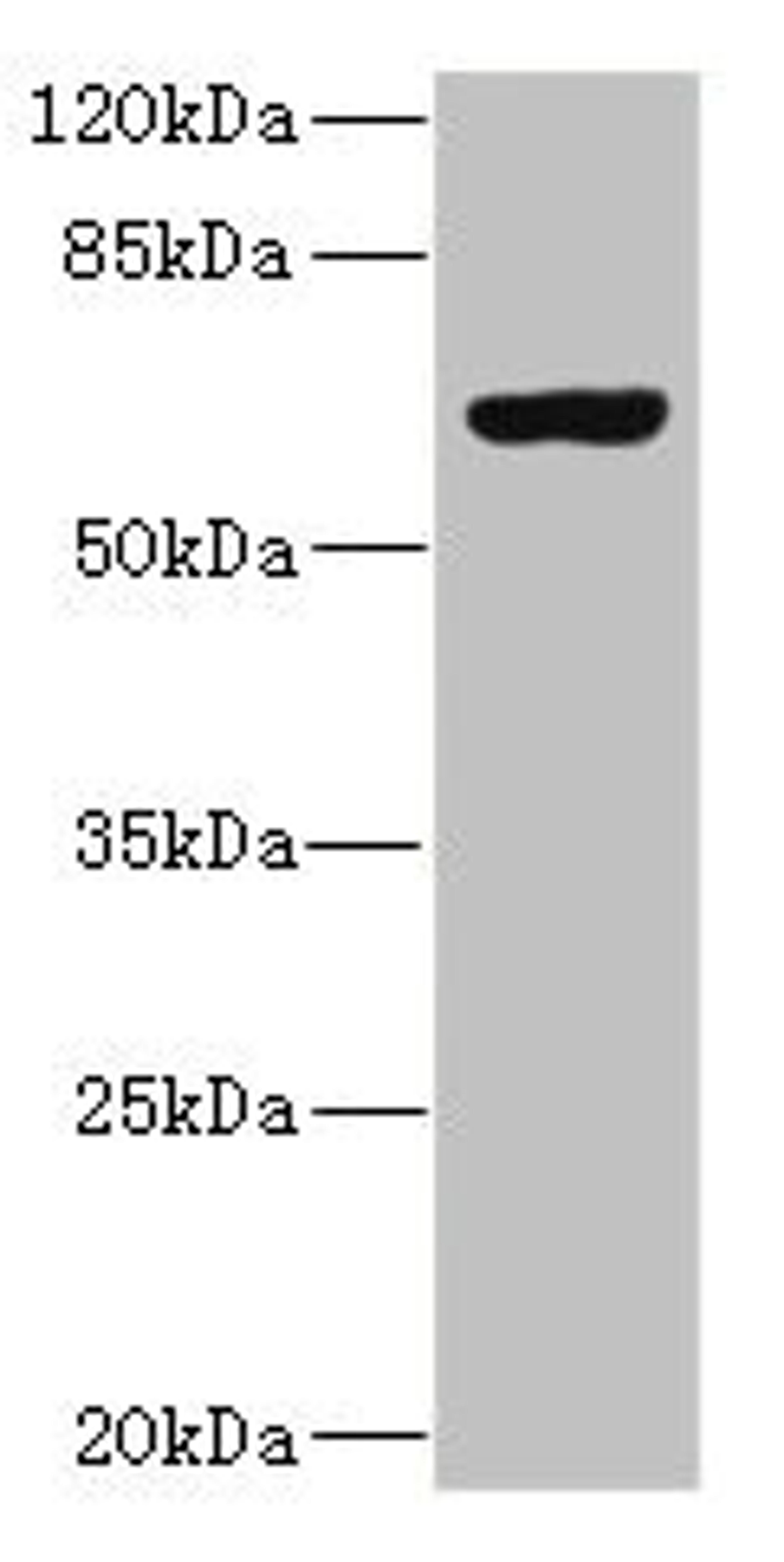 Western blot. All lanes: SLC13A2 antibody at 1.29µg/ml + 293T whole cell lysate. Secondary. Goat polyclonal to rabbit IgG at 1/10000 dilution. Predicted band size: 65, 70 kDa. Observed band size: 65 kDa