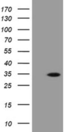 Western Blot: PROSC Antibody (3G7) [NBP2-45396] - Analysis of HEK293T cells were transfected with the pCMV6-ENTRY control (Left lane) or pCMV6-ENTRY PROSC.