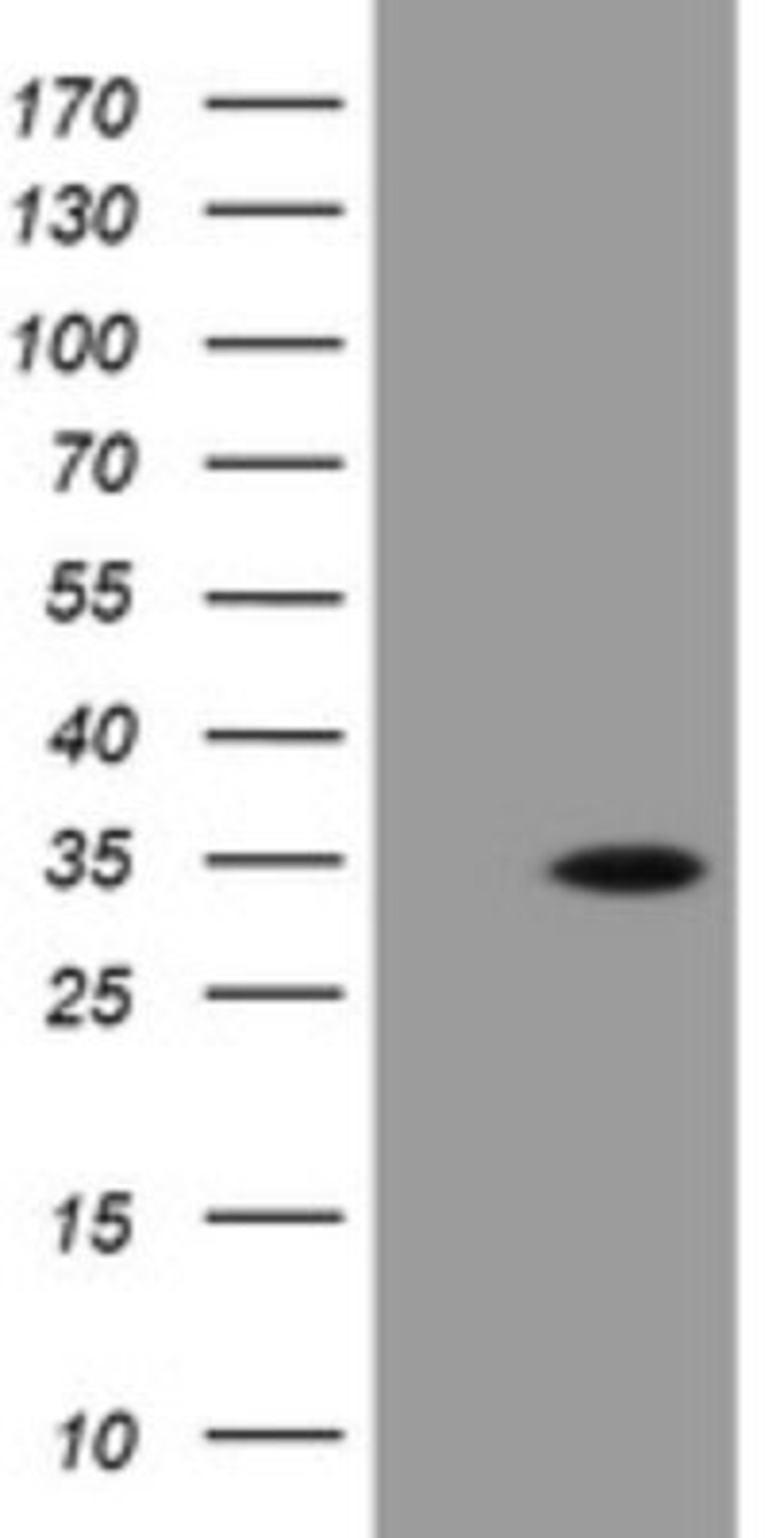 Western Blot: PROSC Antibody (3G7) [NBP2-45396] - Analysis of HEK293T cells were transfected with the pCMV6-ENTRY control (Left lane) or pCMV6-ENTRY PROSC.