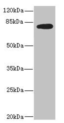 Western blot. All lanes: MEP1B antibody IgG at 2.36ug/ml + Mouse kidney tissue. Secondary. Goat polyclonal to rabbit IgG at 1/10000 dilution. Predicted band size: 80 kDa. Observed band size: 80 kDa. 