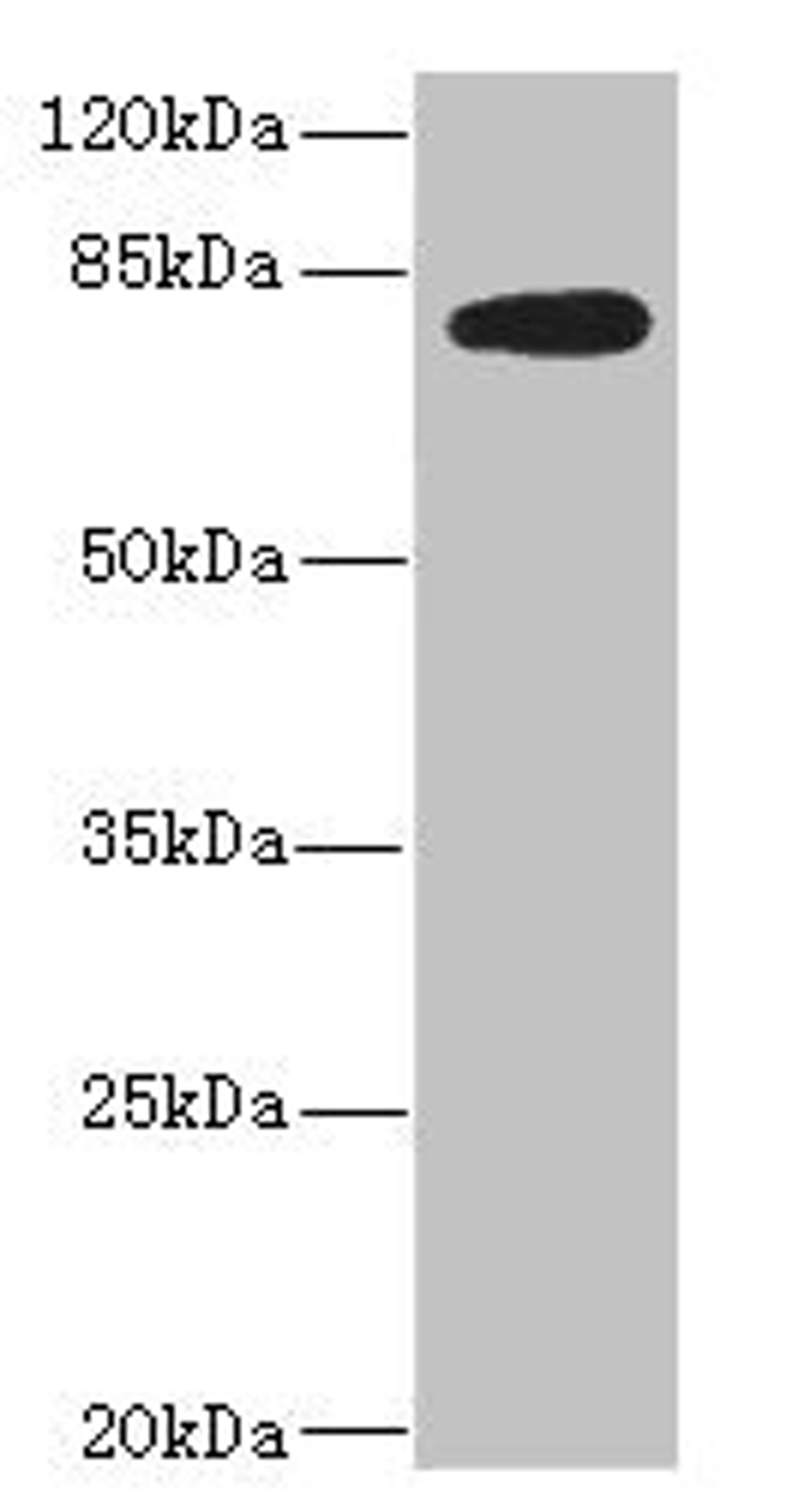 Western blot. All lanes: MEP1B antibody IgG at 2.36ug/ml + Mouse kidney tissue. Secondary. Goat polyclonal to rabbit IgG at 1/10000 dilution. Predicted band size: 80 kDa. Observed band size: 80 kDa. 