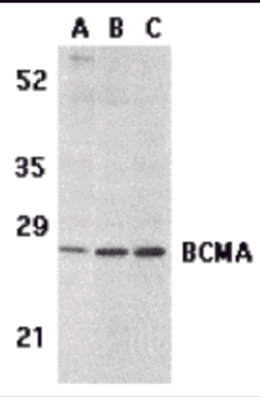 Western blot analysis of BCMA in (A) human spleen tissue lysate, (B) K562, and (C) U937 cell lysates with BCMA antibody at 5 &#956;g/mL. 