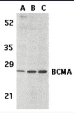 Western blot analysis of BCMA in (A) human spleen tissue lysate, (B) K562, and (C) U937 cell lysates with BCMA antibody at 5 μg/mL.