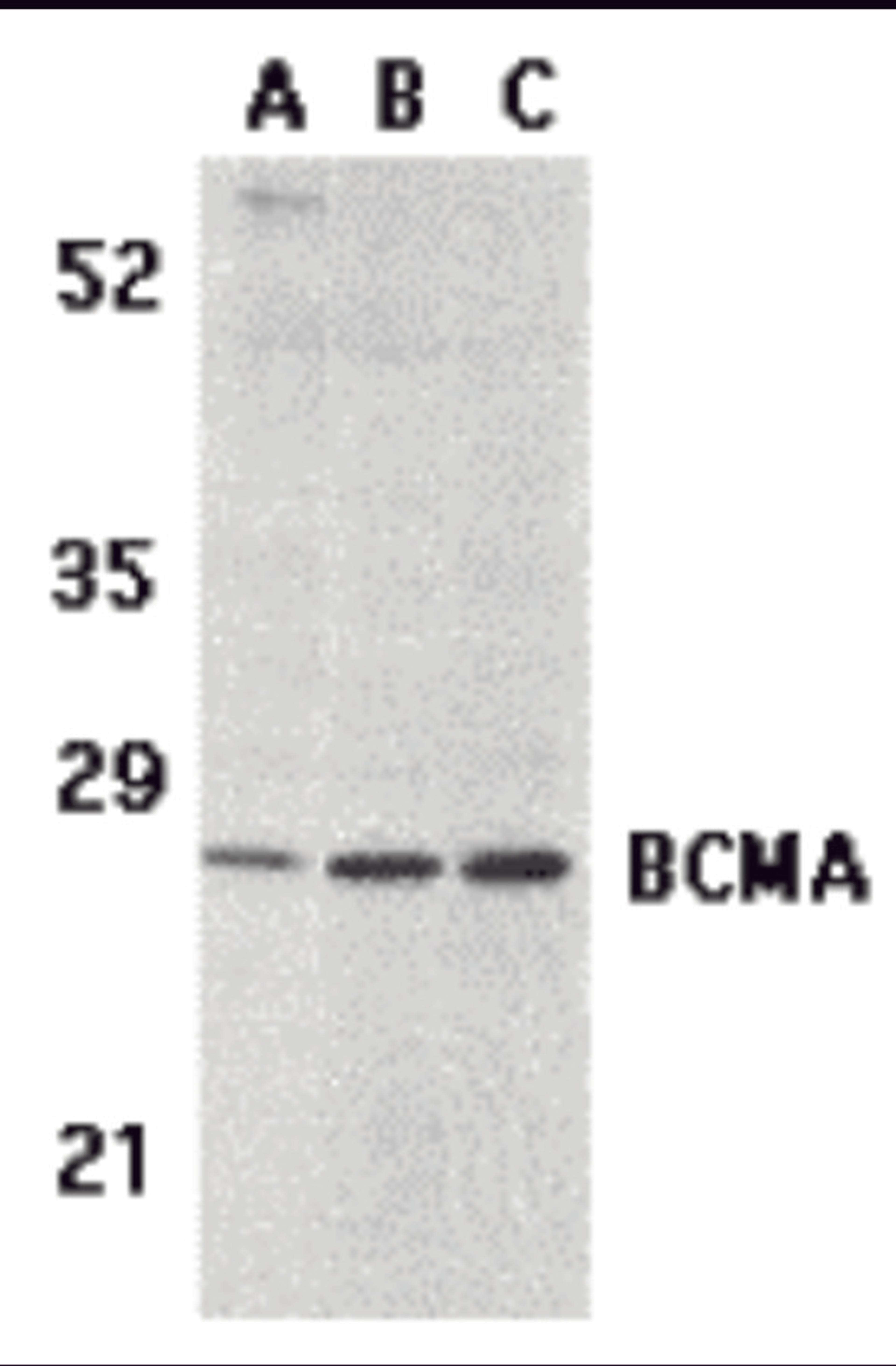 Western blot analysis of BCMA in (A) human spleen tissue lysate, (B) K562, and (C) U937 cell lysates with BCMA antibody at 5 μg/mL.