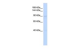 Antibody used in WB on Human HeLa at 0.2-1 ug/ml.