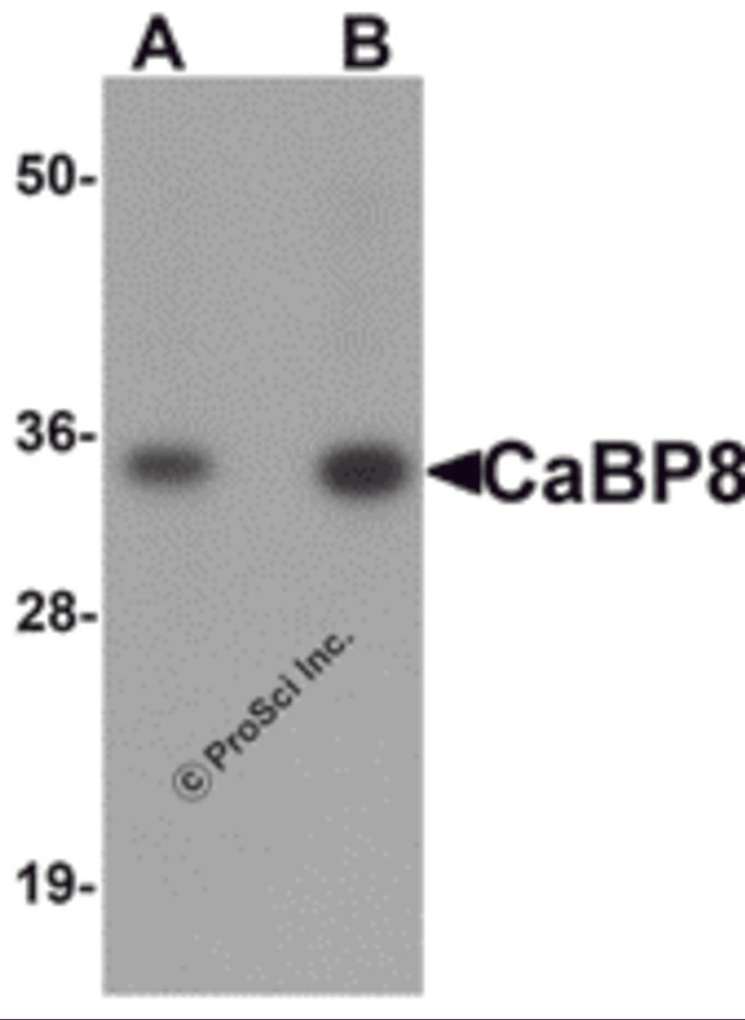 Western blot analysis of CaBP8 in 3T3 cell lysate with CaBP8 antibody at (A) 1 and (B) 2 &#956;g/mL.