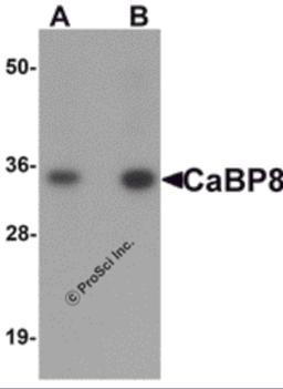 Western blot analysis of CaBP8 in 3T3 cell lysate with CaBP8 antibody at (A) 1 and (B) 2 μg/mL.