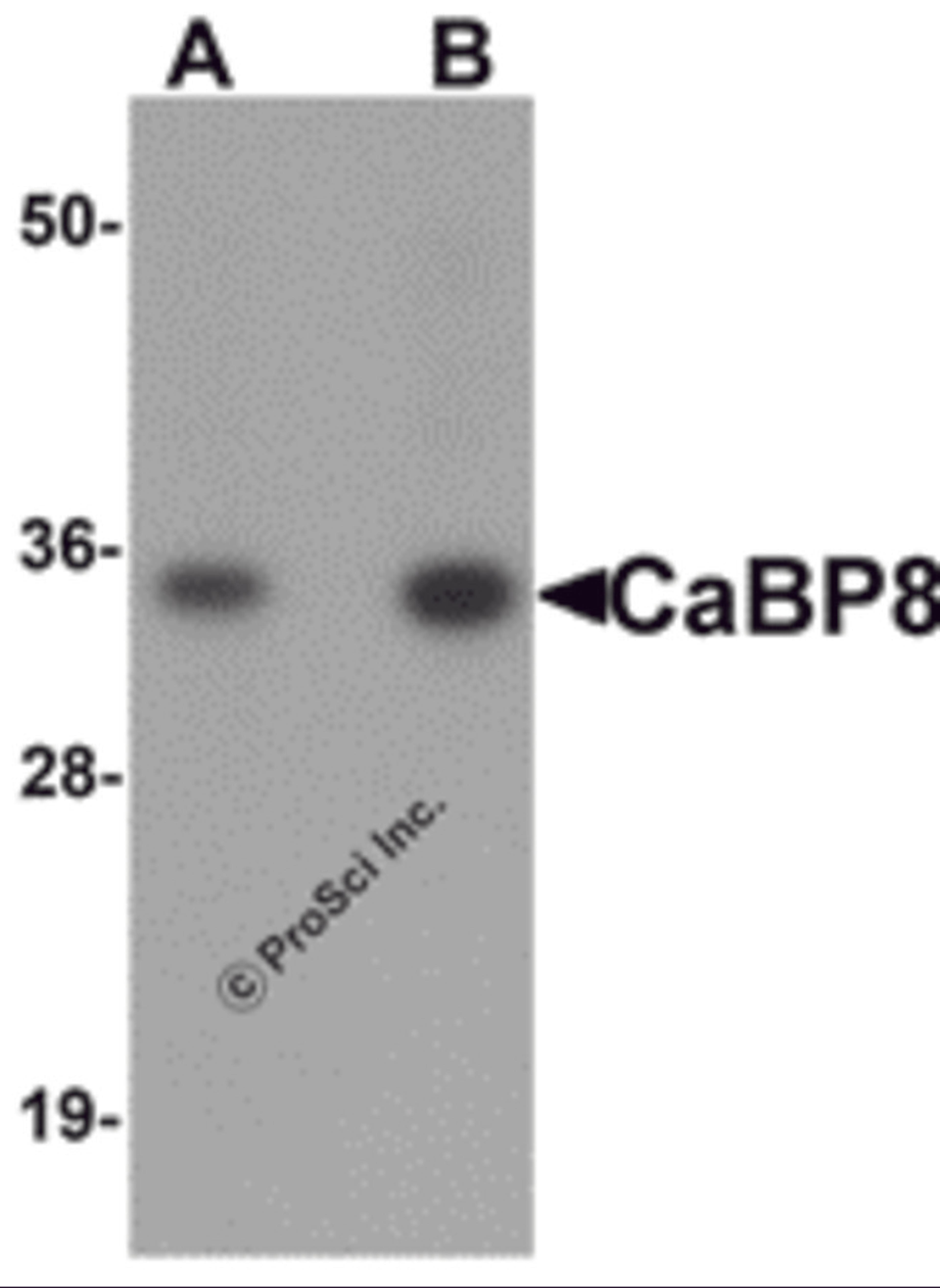 Western blot analysis of CaBP8 in 3T3 cell lysate with CaBP8 antibody at (A) 1 and (B) 2 μg/mL.