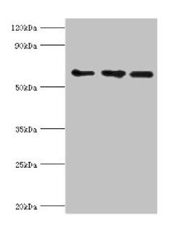 Western blot. All lanes: ABCE1 antibody at 4ug/ml. Lane 1: 293T whole cell lysate. Lane 2: Hela whole cell lysate. Lane 3: k562 whole cell lysate. Secondary. Goat polyclonal to rabbit IgG at 1/10000 dilution. Predicted band size: 67 kDa. Observed band size: 67 kDa. 