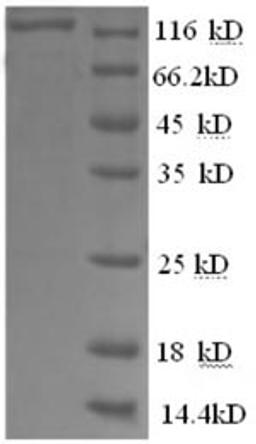 (Tris-Glycine gel) Discontinuous SDS-PAGE (reduced) with 5% enrichment gel and 15% separation gel.