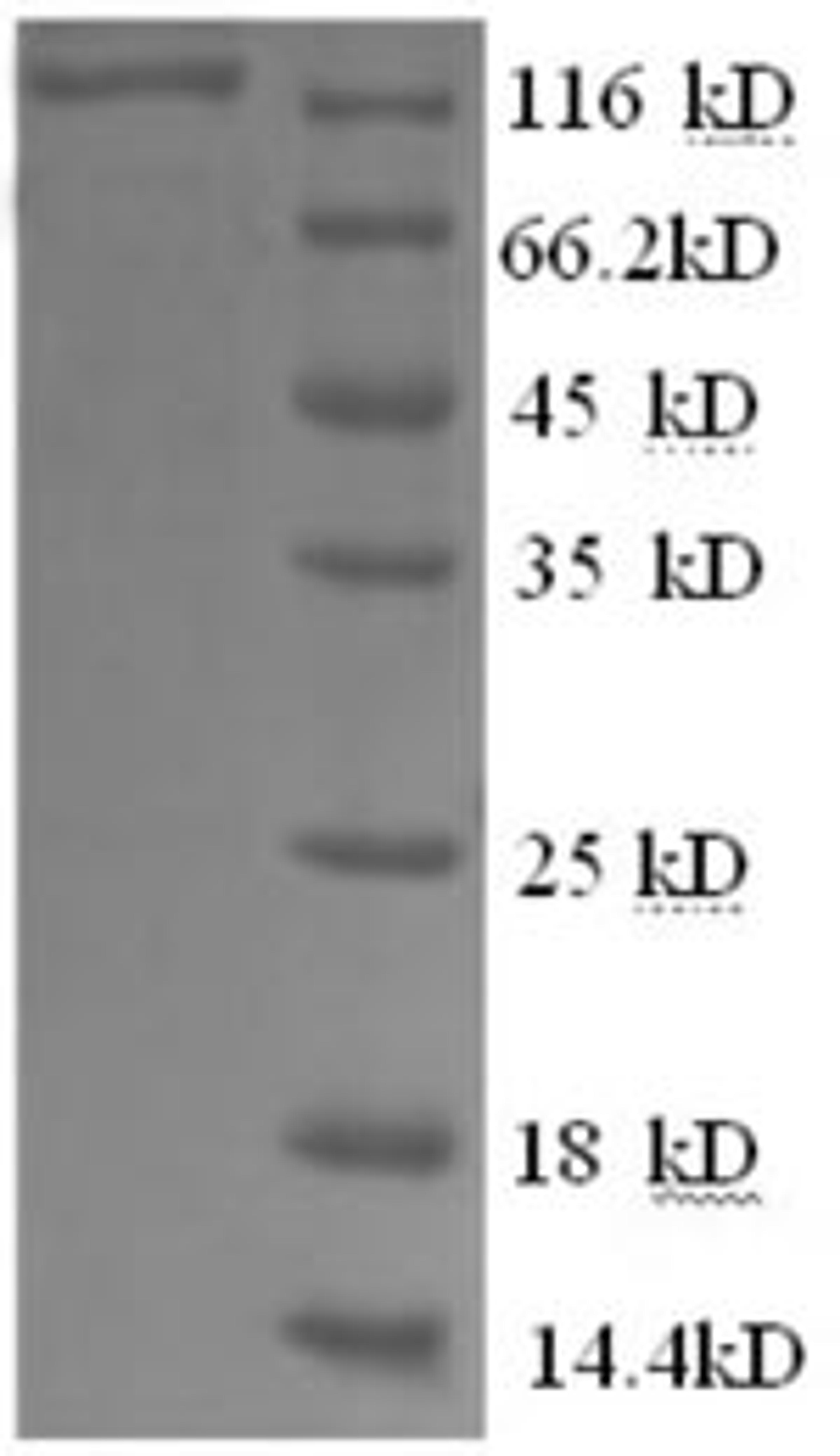 (Tris-Glycine gel) Discontinuous SDS-PAGE (reduced) with 5% enrichment gel and 15% separation gel.