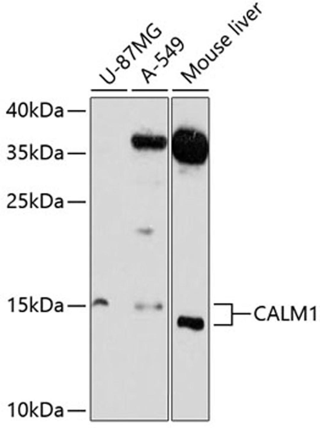 Western blot - CALM1 antibody (A1185)