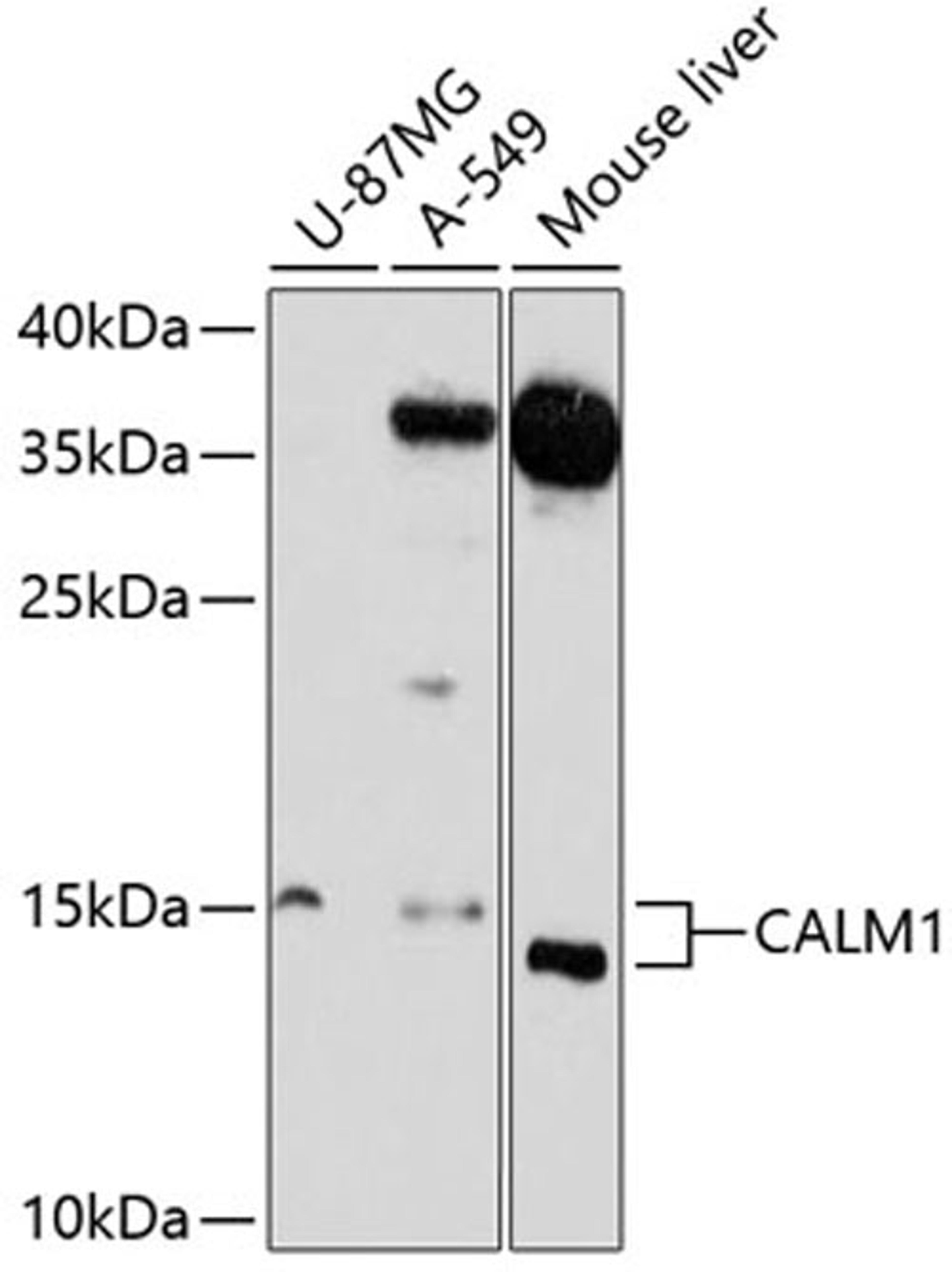 Western blot - CALM1 antibody (A1185)