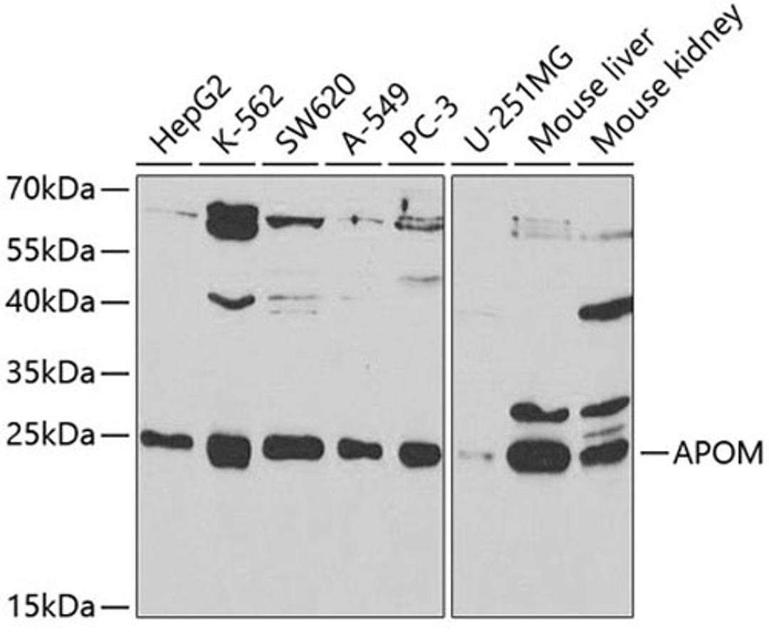 Western blot - APOM antibody (A5336)