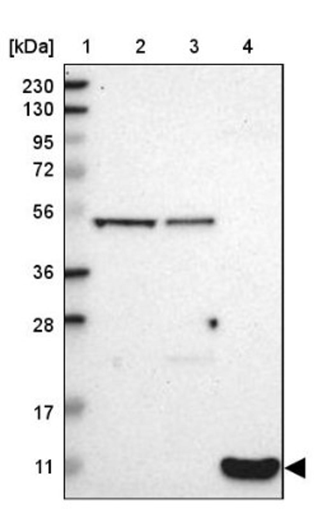 Western Blot: G0S2 Antibody [NBP1-86112] - Lane 1: Marker [kDa] 230, 130, 95, 72, 56, 36, 28, 17, 11<br/>Lane 2: Human cell line RT-4<br/>Lane 3: Human cell line U-251MG sp<br/>Lane 4: Human plasma (IgG/HSA depleted)