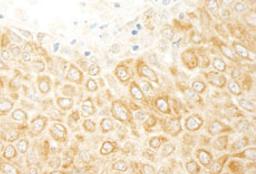 Detection of human ZAK by immunohistochemistry.