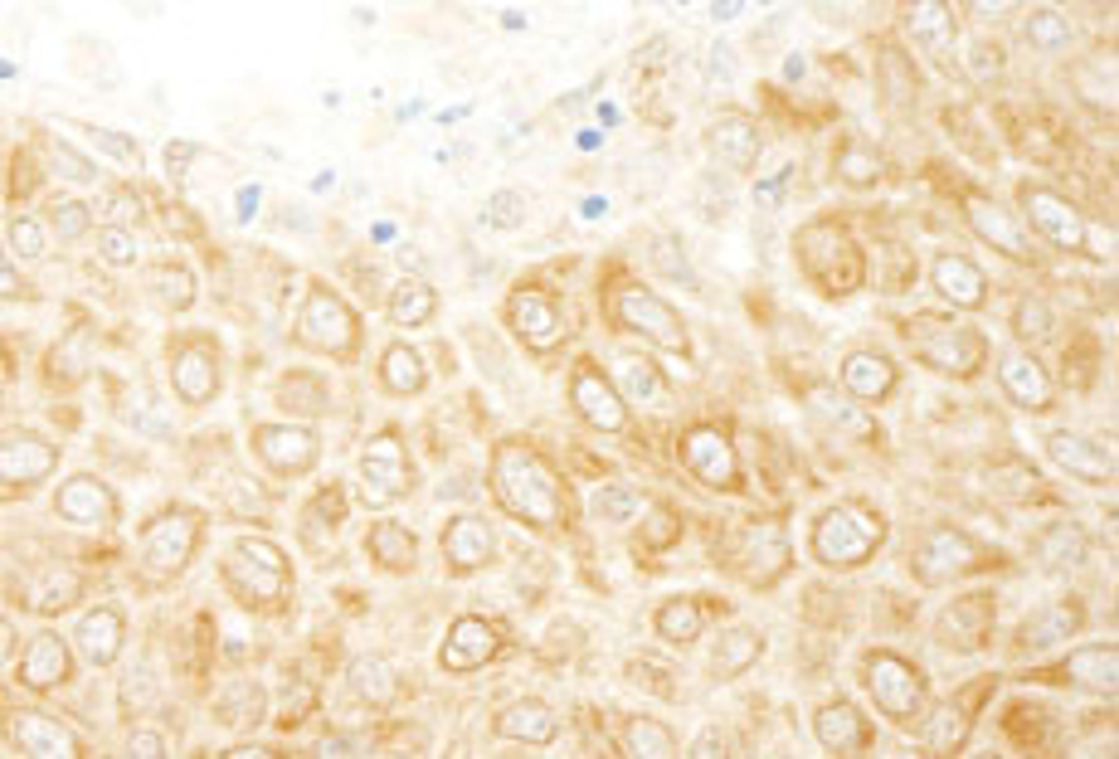 Detection of human ZAK by immunohistochemistry.