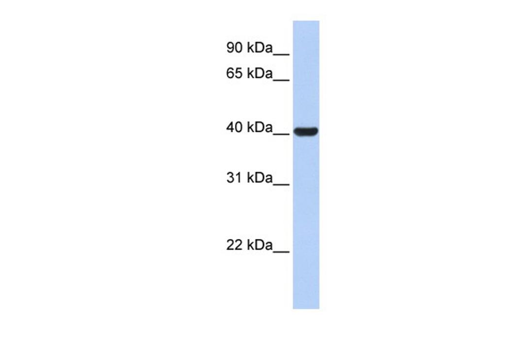 Antibody used in WB on Human Placenta at 0.2-1 ug/ml.