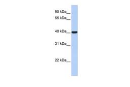 Antibody used in WB on Human Placenta at 0.2-1 ug/ml.