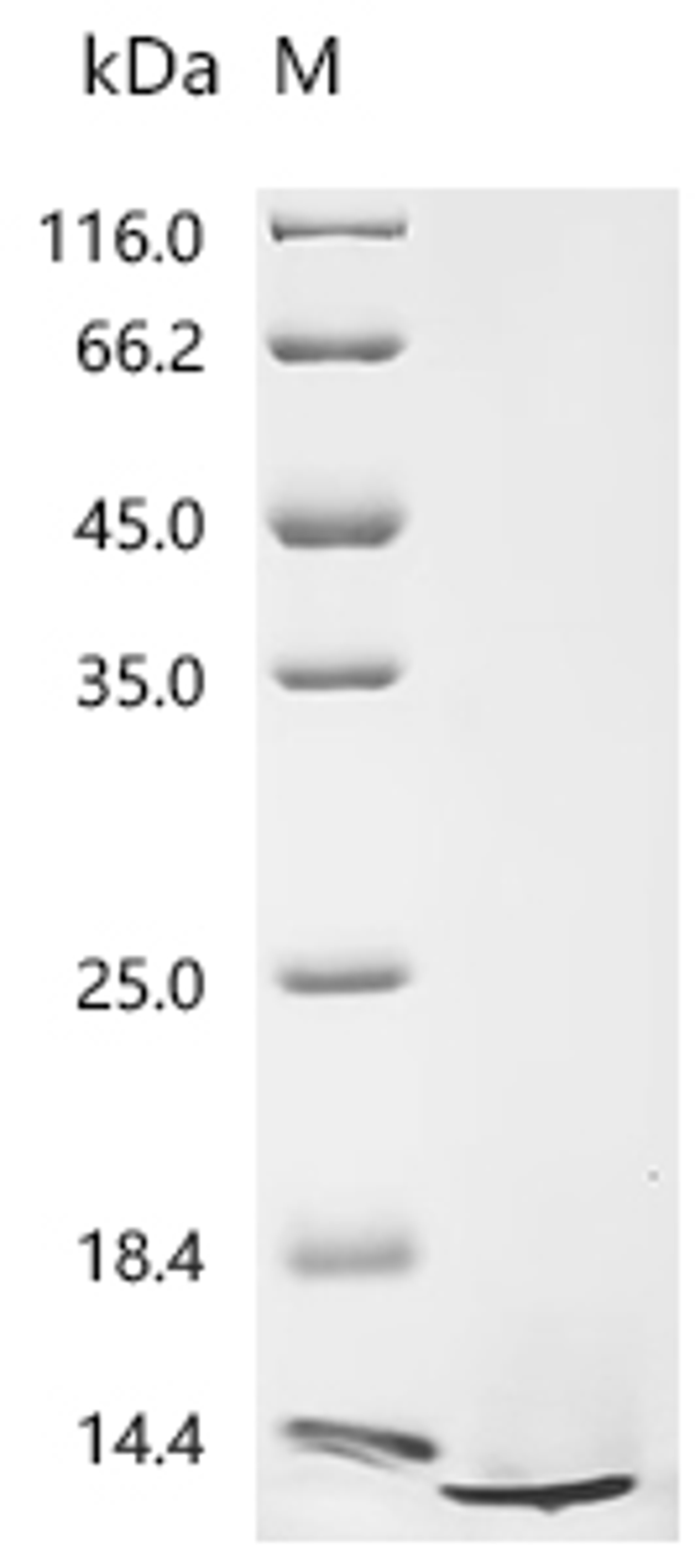 (Tris-Glycine gel) Discontinuous SDS-PAGE (reduced) with 5% enrichment gel and 15% separation gel.