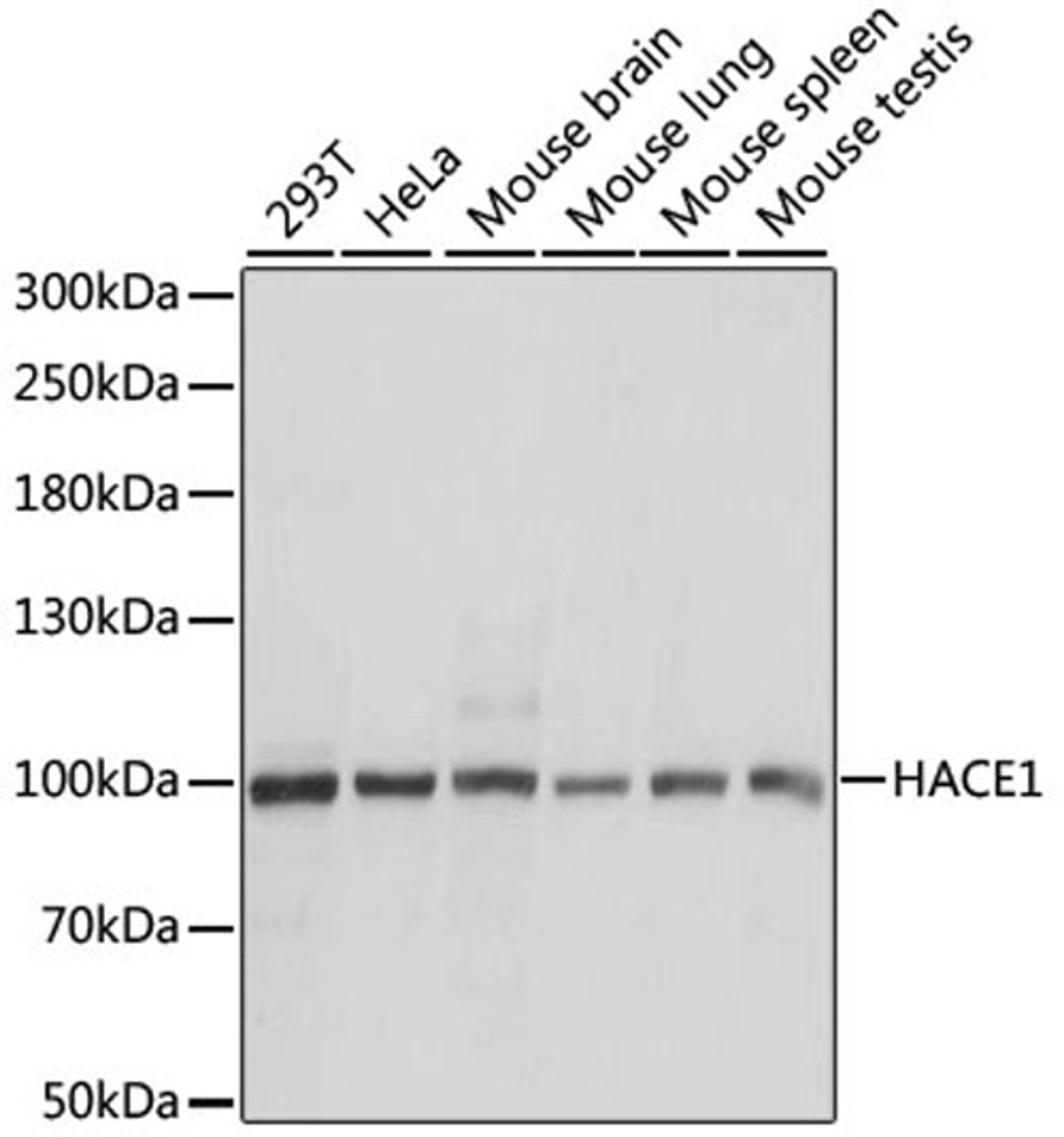 Western blot - HACE1 antibody (A9593)