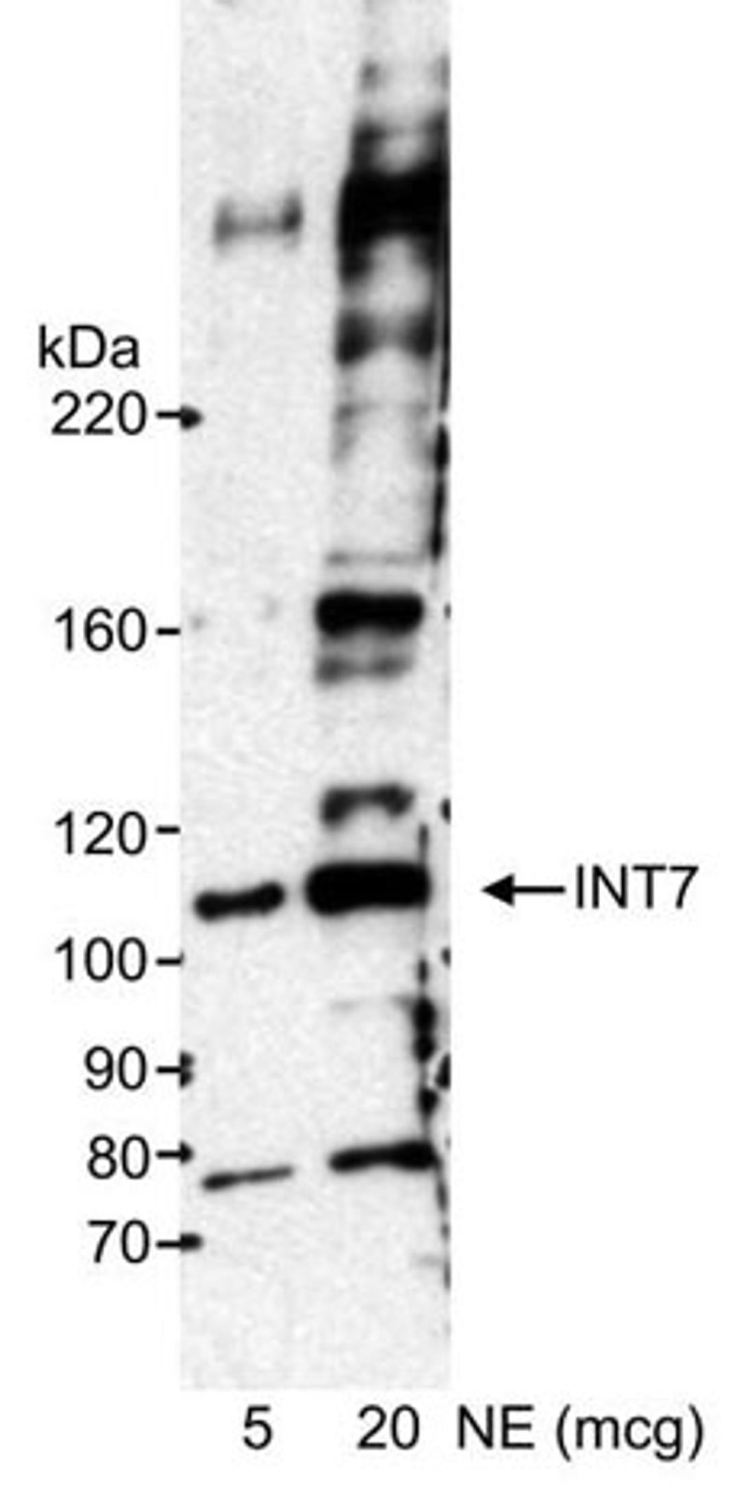 Detection of human INT7 by western blot.