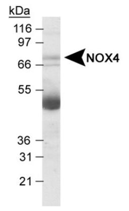 Western Blot: Nox4 Antibody [NB110-58849] - Detection of NOX4 in human kidney lysates using NB110-58849 at 2.0 ug/ml. A non-specific band is often observed running at 50 kDa in tissue lysates which is believed to correspond to the human IgG heavy chain.